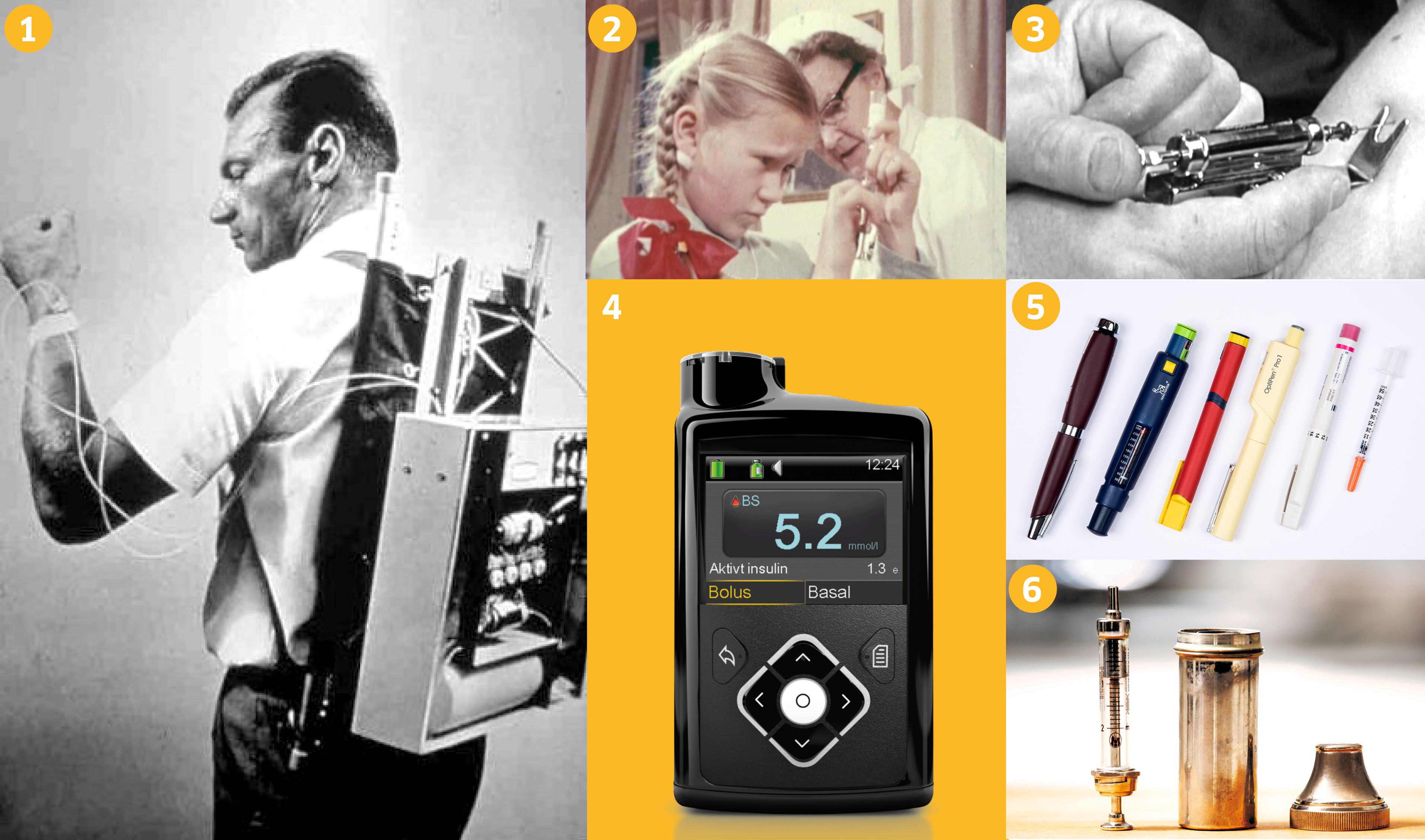 Bilder av sprøyter, insulinpumper og insulinpenner gjennom tiden